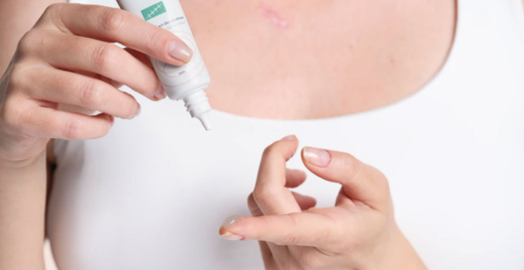 Gros plan macro sur un tube de gel de silicone médical transparent posé sur une surface blanche immaculée avec quelques gouttes de gel translucide visibles